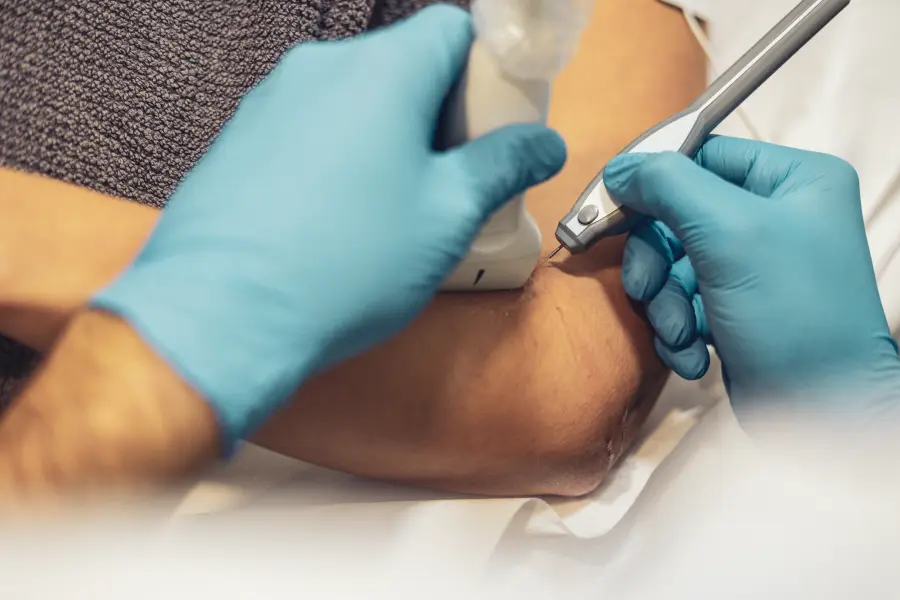 fisioterapia epi madrid algete fisioterapia avanzada